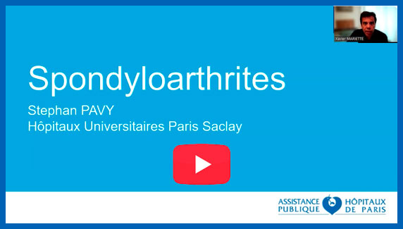 Spondyloarthrite par le Dr Stephan PAVY du service Immuno-rhumatologie de l'Hopital Bicetre AP-HP